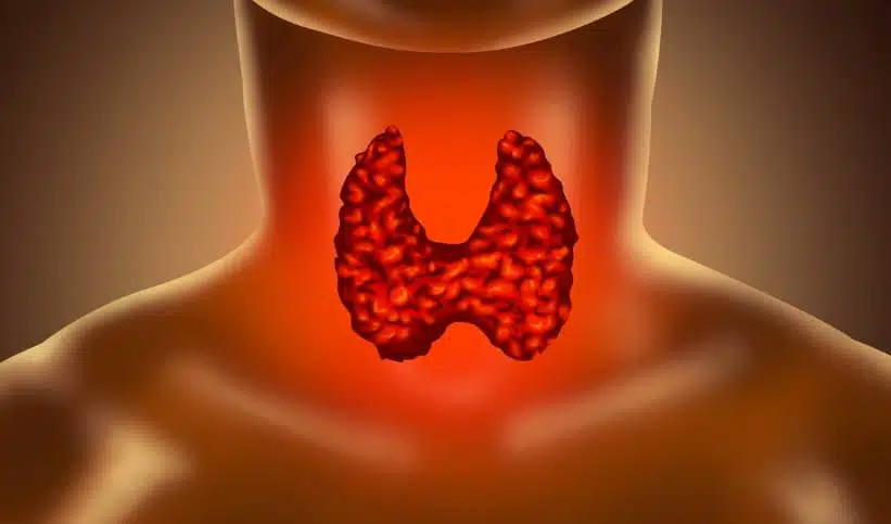 origine et prévalence du cancer de la thyroide